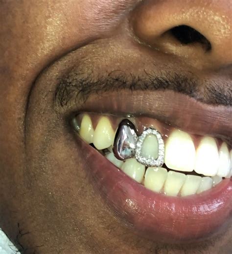 Gold Grillz Specialists On Instagram “open Face Diamond Grill