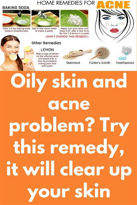 Oily Skin And Acne Problem Try This Remedy It Will Clear Up Your Skin