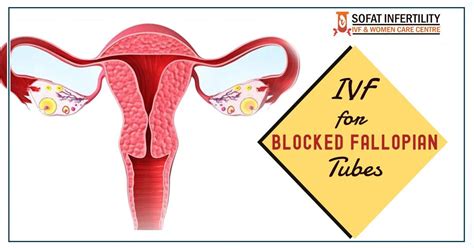Treat The Blocked Fallopian Tubes Problem With Help Of Ivf Treatment