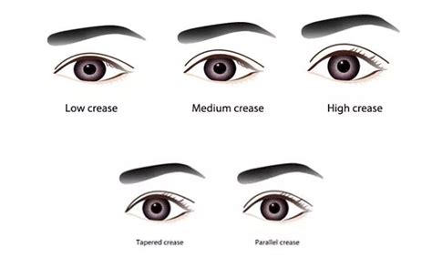 4 Things You Should Know Before Committing To Double Eyelid Surgery