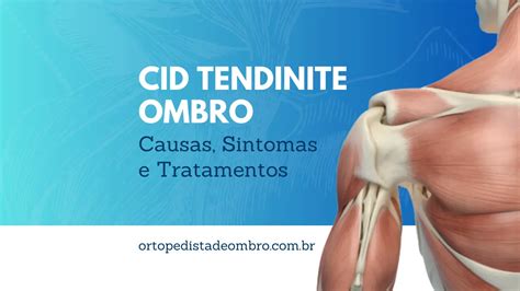 Cid Tendinite Ombro Causas Sintomas E Tratamentos