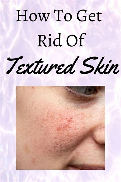 A Lot Of Us Have Textured Skin And Dont Know How To Get Rid Of It