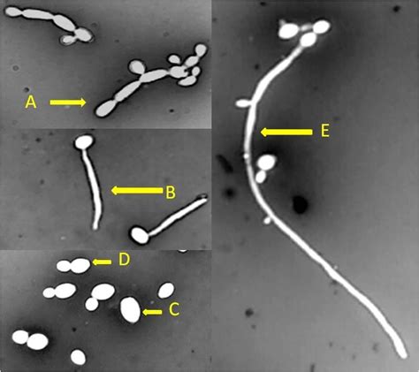 Different Morphological Forms Of Candida Albicans At 100 X Resolution