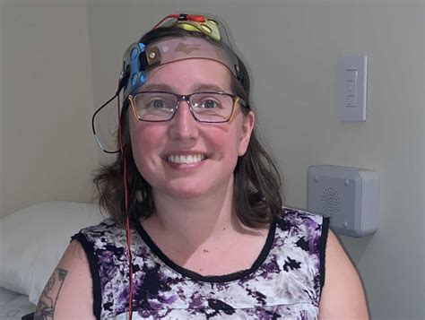 New Csd Study Uses Electrical Brain Stimulation To Help Treat Stroke