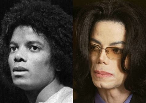 Livro Revela Que Michael Jackson Passou Por Sucessivas Plásticas Para