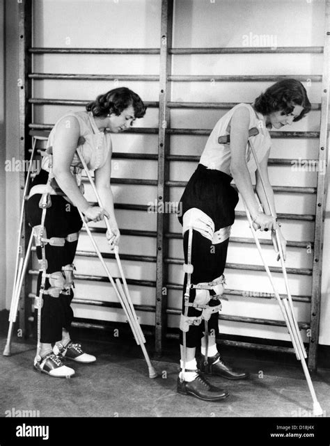 Two Adult Women Polio Victims With Leg Braces Adjust Their