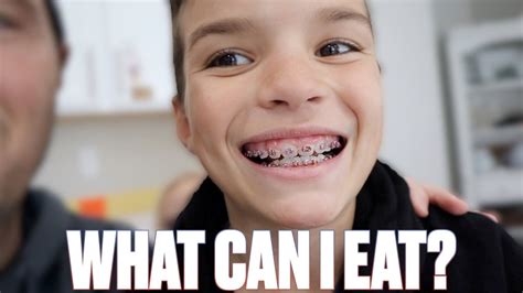 What Hurts The Most Getting Braces For The First Time What You Can And Can T Eat With New