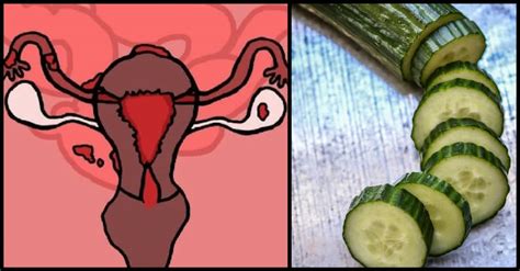 Doctors Warn Against Cucumber Vagina Cleansing