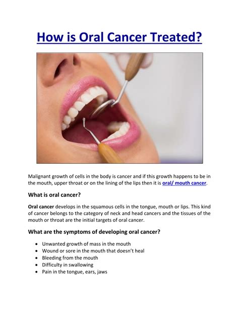 Ppt How Is Oral Cancer Treated Powerpoint Presentation Free