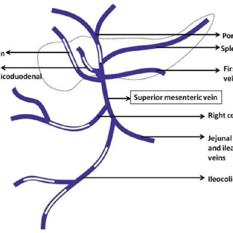 Location Of Pneumobilia And Portal Vein Gas In The Liver Based On The