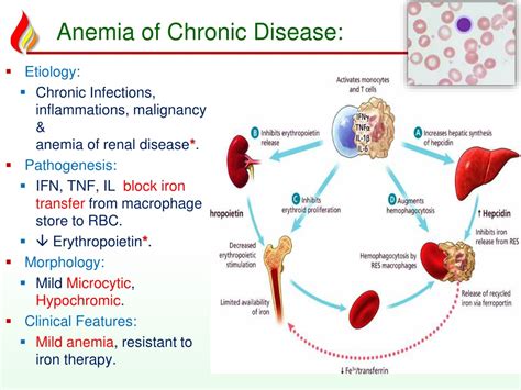 Treatment Of Anemia Of Chronic Disease Sciencehub