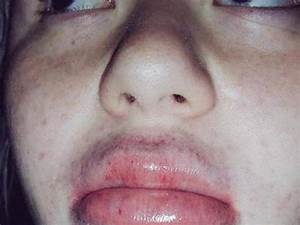  Jenner 39 S Lip Challenge On Instagram Business Insider