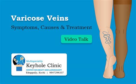 Varicose Veins Treatment In Kochi Keyhole Clinic Edappally