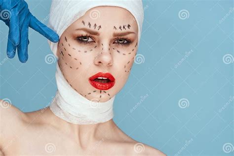 Female Patient Red Lips Plastic Surgery Operation Bare Shoulders Blue Background Stock Image