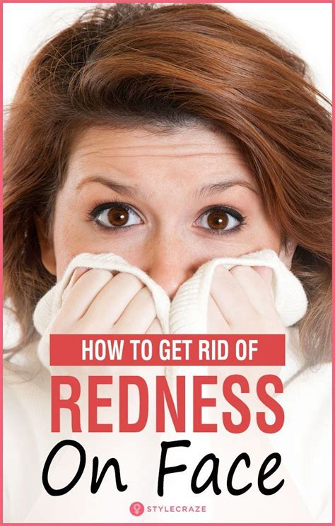Home Remedies To Get Rid Of Redness On The Face Redness On Face