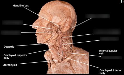 Head And Neck Deep Muscles Lateral View I Diagram Quizlet