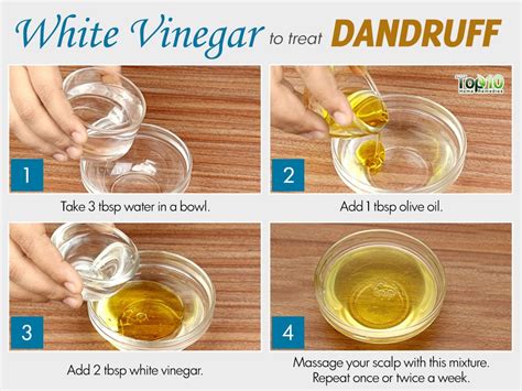 How to use neem oil for hair? Home Remedies for Dandruff | Top 10 Home Remedies