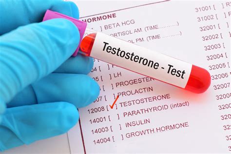 What Is Testosterone Serum Female Lab Results