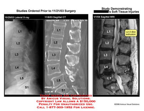 What is the main difference between ct scan and mri and which one is best. Soft Tissue Injuries