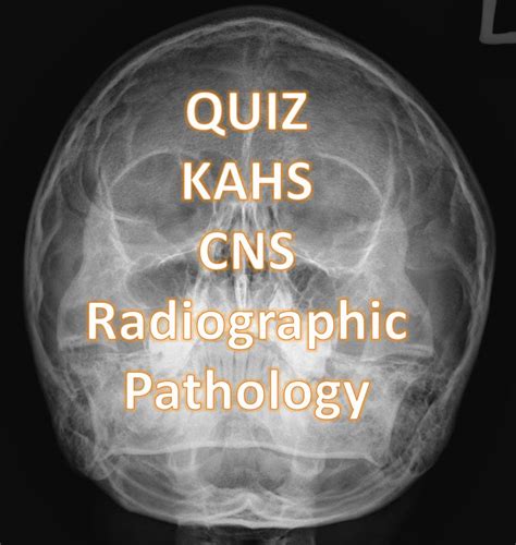Quiz Radiology Cases