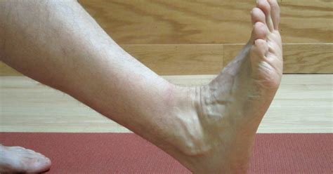 Ankle Sprains Acute Phase Part I Of Iii The Physical