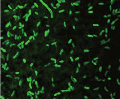 Vibrio Fischeri Tintadas Con Fluoresceína Para Evaluaciones