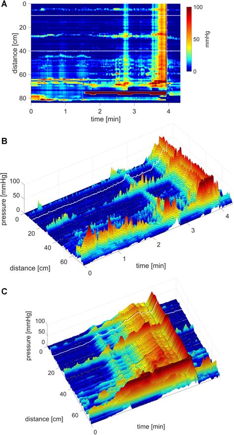Frontiers Characterization Of Simultaneous Pressure Waves As