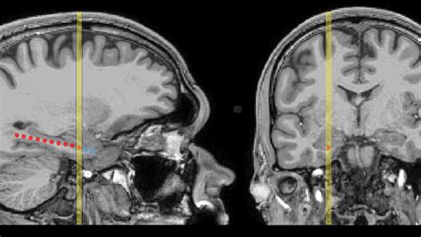 A Look Inside The Brain During Sleep Shows How Memory Is Stored Northwestern Now