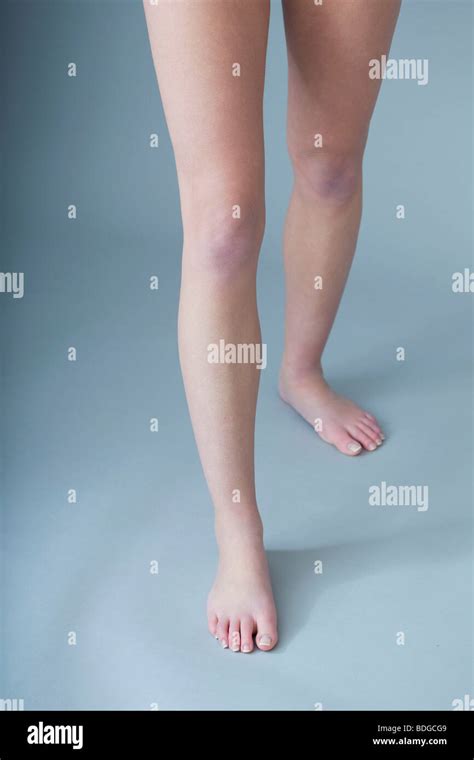 Leg Stock Photo Alamy