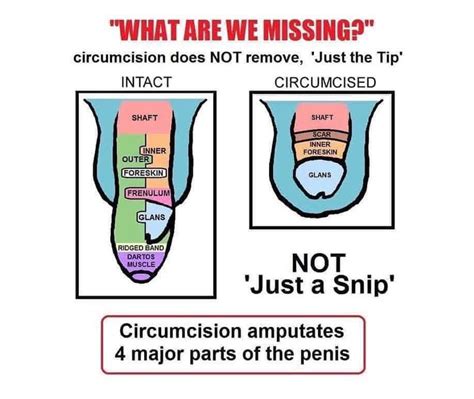 Male Circumcision The Unkindest Cut Freshmag