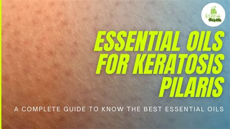 Essential Oils For Keratosis Pilaris A Complete Guide To Know The Best