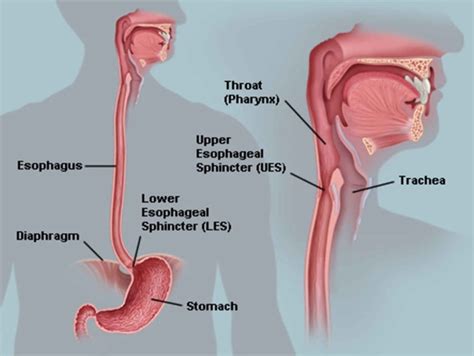 Esophageal Dysmotility Esophageal Motility Disorder Causes Symptoms