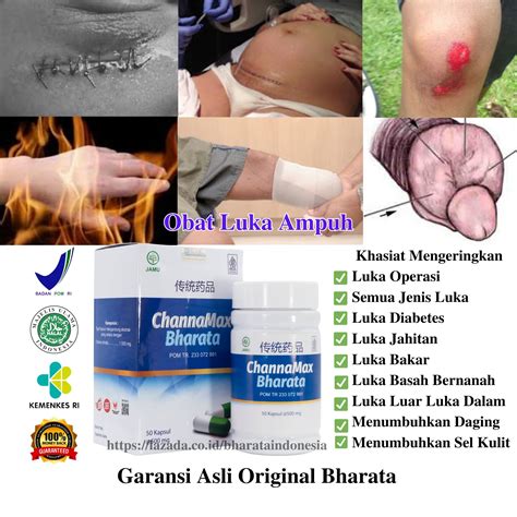 Obat Pengering Luka Ampuh Channamax Bharata Obat Penyembuh Luka Obat