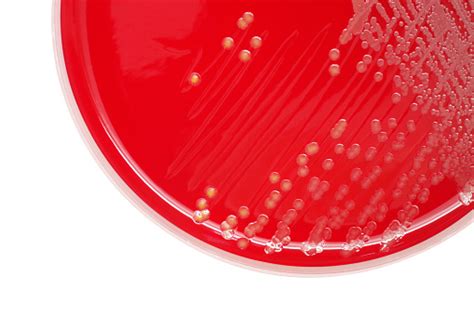 Staphylococcus Aureus Bacterial Colonies On Blood Agar Plate Stock