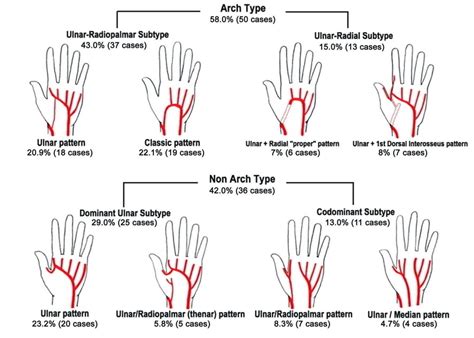 Classification Of The Superficial Arterial Palmar Irrigation