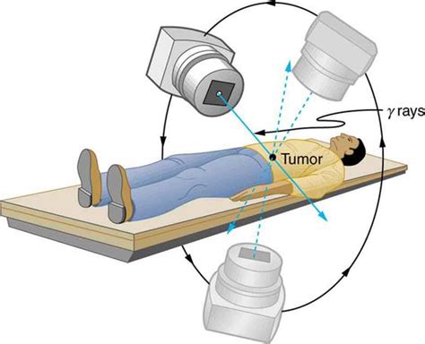 Free Cliparts Radiation Treatment Download Free Cliparts Radiation
