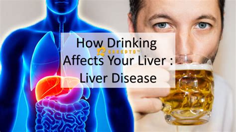 How Drinking Affects Your Liver Liver Disease
