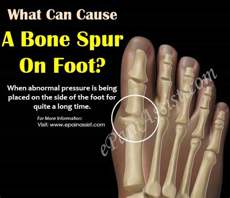 The top countries of suppliers are china, singapore, and taiwan. ️ Foot bones. Bones of the Foot Diagram. 2019-02-28