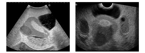 Maybe you would like to learn more about one of these? Female Pelvic Ultrasound Phantom at Imaging Solutions ...