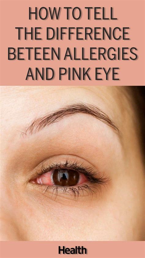 Pink Eye Or Allergies Here’s How To Tell Salud Bordado A Mano