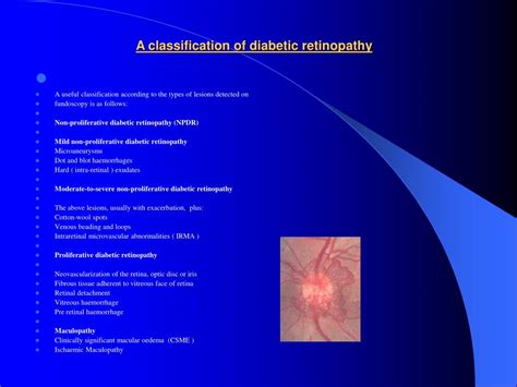 Photocoagulation treatment of proliferative diabetic retinopathy. PPT - Diabetic Retinopathy PowerPoint Presentation - ID ...