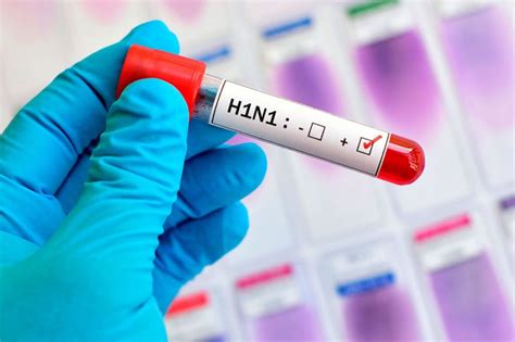 Maranhão Tem 15 Casos Confirmados De H1n1 O Imparcial