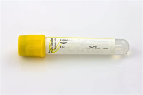 Test Tube With Yellow Plug Stock Photo Image Of Disposable 33988950