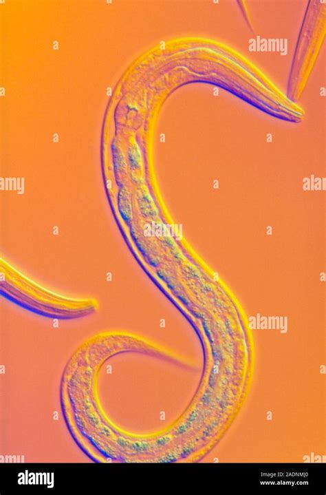 Caenorhabditis Elegans Nematode Worm Light Micrograph This Soil