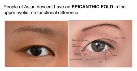 Epicanthal Folds Vs Normal Eye News Word