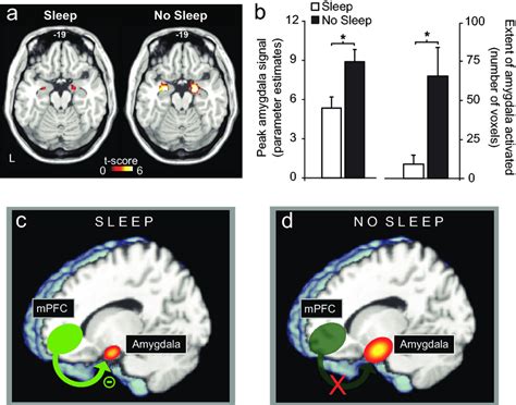 the impact of sleep deprivation on emotional brain reactivity and download scientific diagram