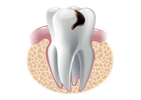Odontología Conservadora Dental Avenida