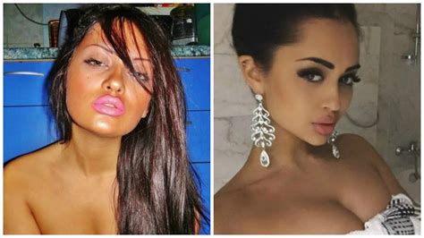 Stars Before And After Plastic Surgery