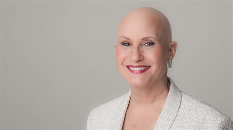 Living With Alopecia Areata Coming To Terms With Hair Loss Goodrx