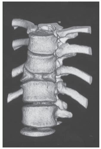 Imaging Techniques In Orthopaedics Radiology Key